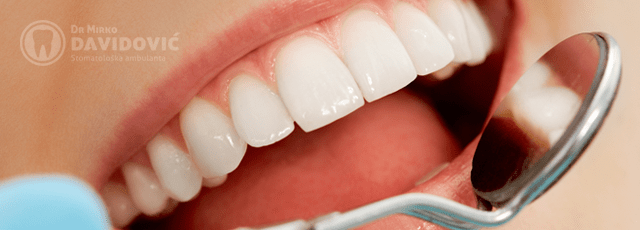 stomatologija-davidovic-popravak-zuba-header
